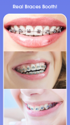 Teeth Braces Photo editor screenshot 5