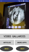 Ultrasound Video screenshot 2