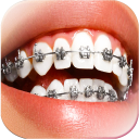 Braces Camera Photo Editor