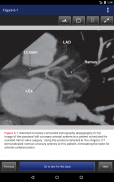 Cardiac Surgery in the Adult, 5th Edition screenshot 11