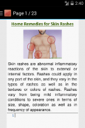 How to Cure Skin Rashes screenshot 1