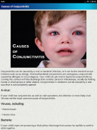 Conjunctivitis & Pinkeye Help screenshot 8