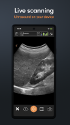 Clarius Ultrasound App screenshot 0