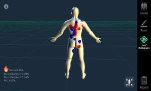 3D Burn Resuscitation screenshot 7