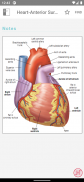 ECG Notes: Quick look-up ref. screenshot 13