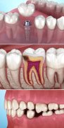 Dental 3D Illustrations screenshot 8