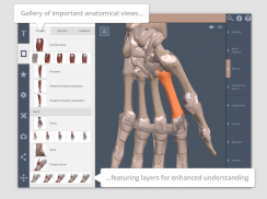 Forearm and Hand: 3D RT - Sub screenshot 6