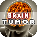 Brain Tumor: Causes, Diagnosis, and Treatment