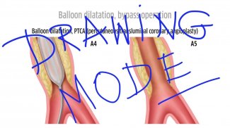 Patient Education Institute screenshot 9