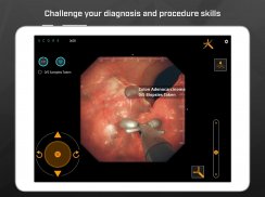 Gastro Ex: Played by Gastroent screenshot 2