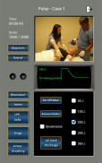 心电图节律和脉搏 screenshot 6