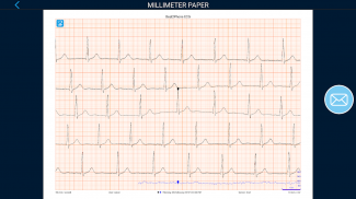 Beat2Phone ECG screenshot 2