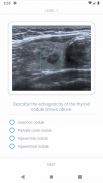 Thyroid Nodules - Ultrasound Guide screenshot 4