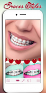 Braces Photo Editor screenshot 5