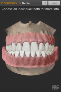 BoneBox™ - Dental Lite screenshot 0