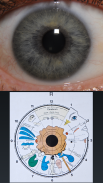 Diagnóstico ocular screenshot 4