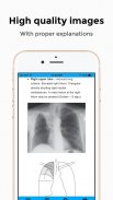 CXR FlashCards - Reference app for Chest X-rays screenshot 0