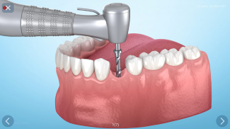 Dental 3D Illustrations screenshot 20