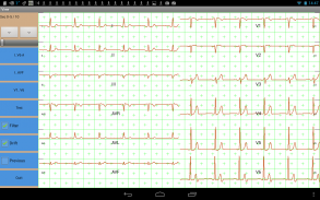 Mobile ecg recording screenshot 0