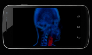 Body Xray- Prank screenshot 0