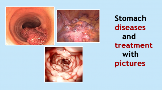 All Stomach Disease &Treatment screenshot 4