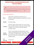 ECG FlashCards 2 Lite - Free Reference EKG App screenshot 5