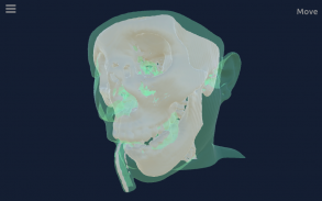 CT Scan Viewer 3D screenshot 2