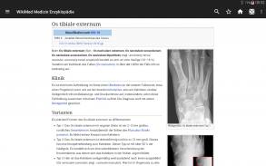 Wikipedia Medizin (Offline) screenshot 7
