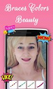 Braces Colors Beauty screenshot 4