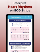 ECG EKG Interpretation Mastery screenshot 5