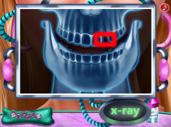 Teeth And Tongue Doctor : Hollywood Smile screenshot 3