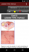 Fitzpatrick's Derm Flash Cards screenshot 15