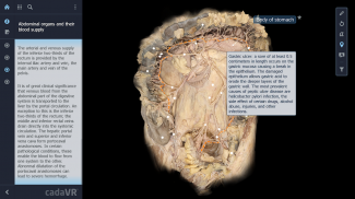 cadaVR anatomy screenshot 5