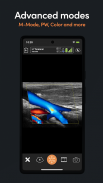 Clarius Ultrasound screenshot 4