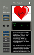 心电图节律和脉搏 screenshot 4