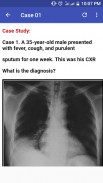 Chest X-Ray Based Cases screenshot 1