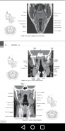 CT Scan Cross Sectional Anatomy for Imaging Pros screenshot 1