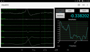 AttysEEG screenshot 8