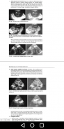 Advances in Ultrasound in Obstetrics & Gynecology screenshot 4