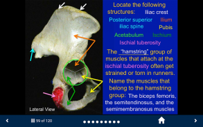 MSK Anatomy - SecondLook screenshot 0