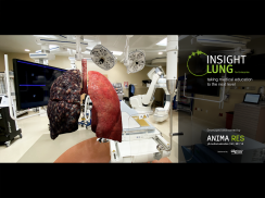 INSIGHT LUNG Enterprise screenshot 9