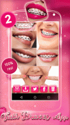 Teeth Braces App 2 screenshot 3