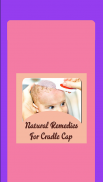 Natural Remedies For Cradle Cap screenshot 4