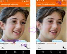 Face Pimple Blemish Remover screenshot 4