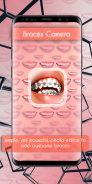 Braces Camera Photo Editor screenshot 5