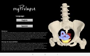 myProlapse: Anatomy of Post-Hysterectomy Prolapse screenshot 15