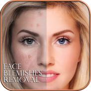 Face Blemishes Removal screenshot 2