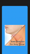 Home Remedies For Strep Throat screenshot 6