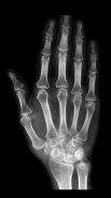 Röntgenscanner Prank screenshot 3