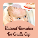 Natural Remedies For Cradle Cap